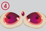 4 Augen