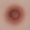 Areola-05