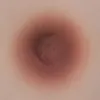 Areola-06