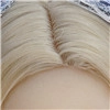 hair-Haartransplantation-Weiß