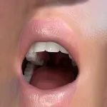 ROS Oral Ja