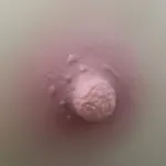 1-Nippelfarbe