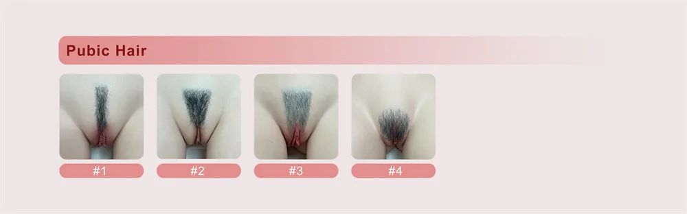 MD Schambehaarung