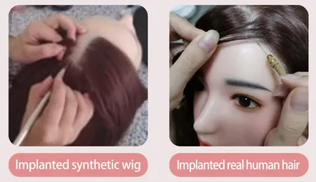 Haartransplantation
