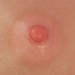 Rosa-Nippelfarbe