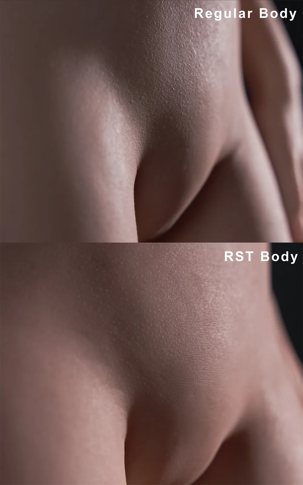 Bauch RST