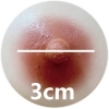 3cm