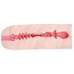 Vagina-Formkern 1