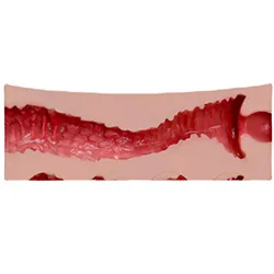 Vagina-Formkern 5